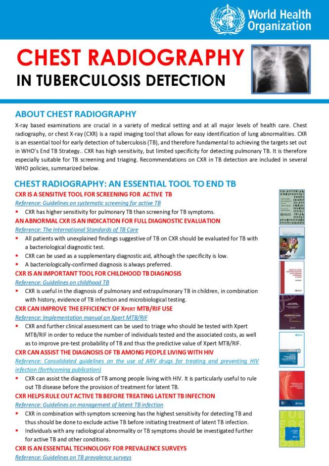 Chest Radiography in Tuberculosis Detection